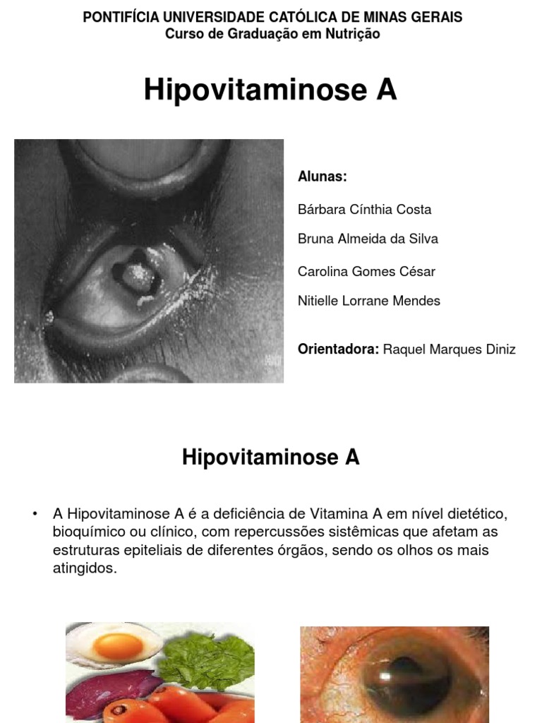 hipovitaminose a